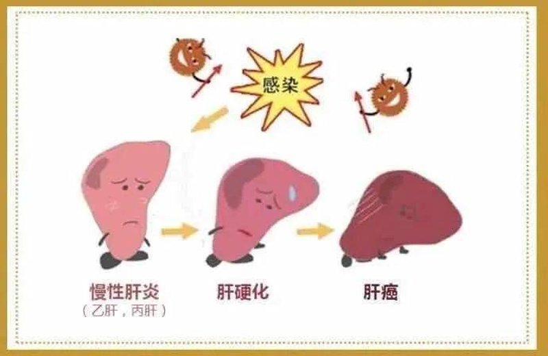 成都肝病医院哪家好？这里告诉你真相！