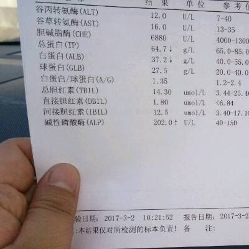 成都肝病医院哪家更值得信赖？