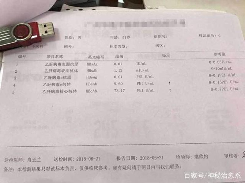 丙肝：从无法治愈到可治可控之路