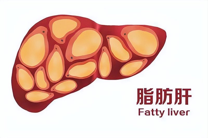 四川华西肝病研究院：引领肝病诊疗新风尚
