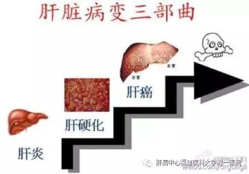 成都肝病医院哪家更值得信赖