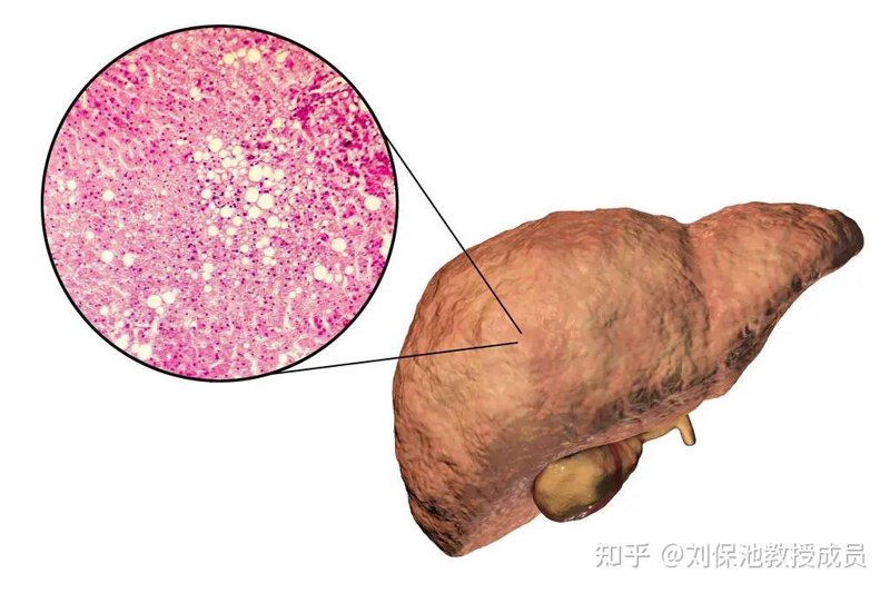 四川华西肝病研究院：肝病防控前沿探索的力量